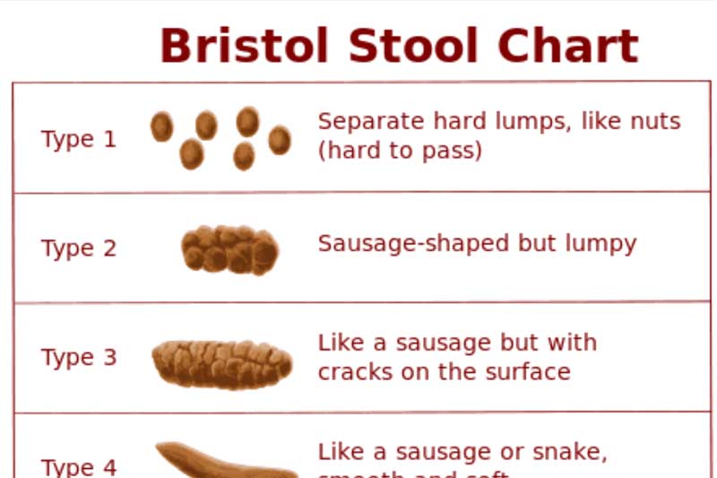 Image showing Bristol Stool Chart.